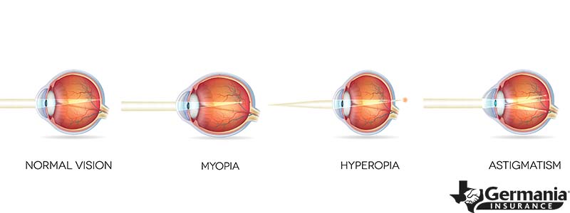 A diagram of refractive errors in the human eye